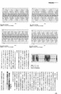 ウッドミック